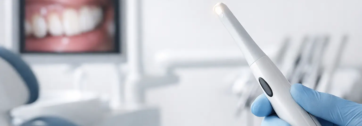 Cámara intraoral para odontología: cómo elegir