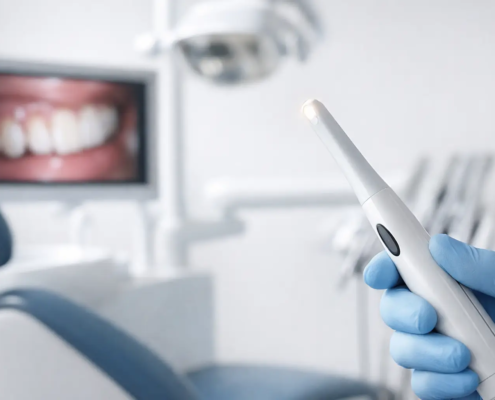 Cámara intraoral para odontología: cómo elegir