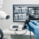 Radiovisiógrafo dental digital: qué revisar