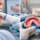 Escáner intraoral vs impresión tradicional