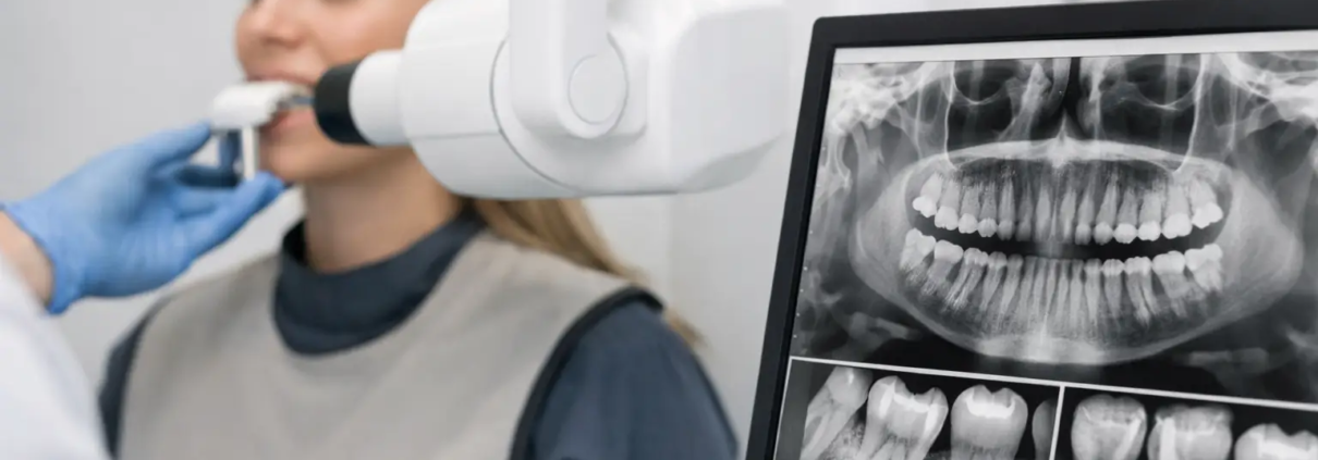 Rayos X dental: cómo elegir el equipo ideal