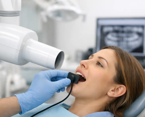 Guía de rayos X intraoral para tu consultorio