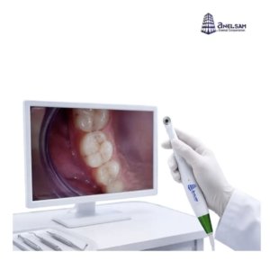 Kit Multimedia con camara intraoral y monitor touch marca Anelsam