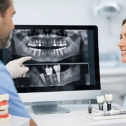 Qué radiografía necesita implantología dental