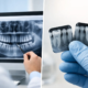 Radiografía panorámica vs periapical dental