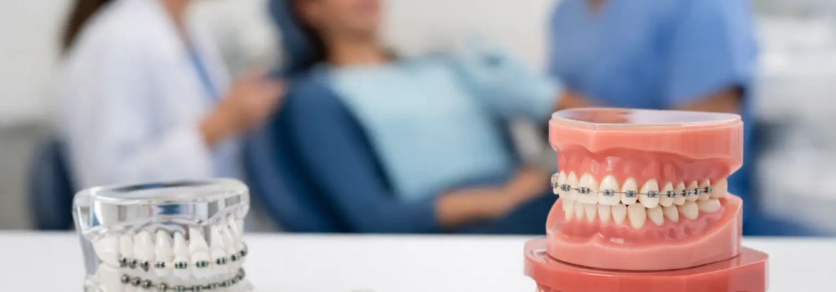 Paquetes odontológicos para ortodoncia rentables