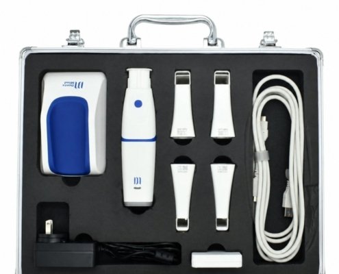 scanner_3D_DentsMind_5