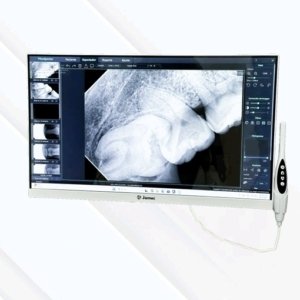Kit Multimedia con camara intraoral Todo en uno JAMEC 24 pulgadas